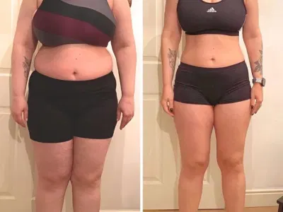 VittaBurn customer Jennifer before and after photos