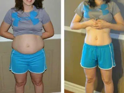 VittaBurn customer Rebecca before and after photos